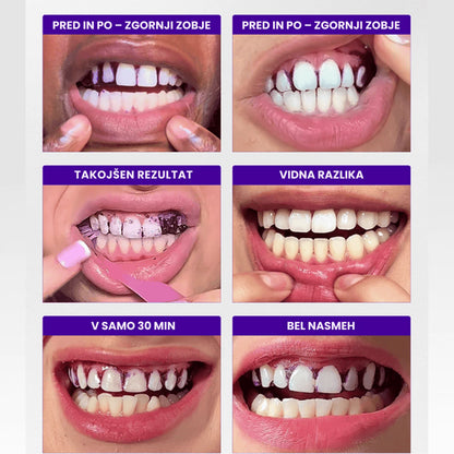 Belilni trakovi Brytty V34