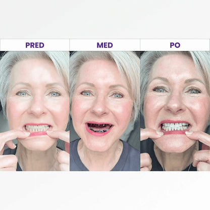 Belilni trakovi Brytty V34