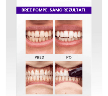 Belilni trakovi Brytty V34